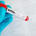 Alarma por el aumento de sífilis en Argentina